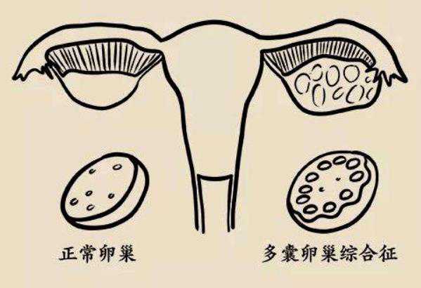 渭南不孕不育症状解析与助孕治疗指南
