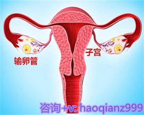 晋城不孕不育常见症状及代怀助孕解决方案